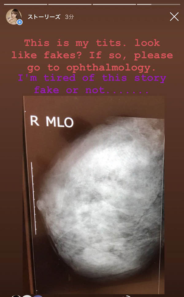 图片[4]-暗黑第一球霸《Hitomi》精选作品推荐介绍及封面预览-乐忧记